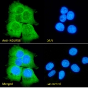 Western blot testing of mouse heart lysate with NDUFS8 antibody at 0.1ug/ml. Predicted molecular weight: ~24kDa.