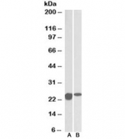 Western blot of mouse (A) and rat (B) spinal cord lysates with SOD2 antibody at 0.01ug/ml.  Predicted molecular weight ~25kDa.