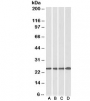 Western blot of human cerebellum (A), mouse brain (B), rat brain (C) and pig brain (D) lysates with SOD2 antibody at 0.3ug/ml. Predicted molecular weight ~25kDa.