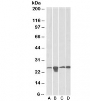 Western blot testing of A) HeLa, B) HepG2, C) HEK293 and D) mouse NIH3T3 lysate with SOD2 antibody at 0.1ug/ml. Predicted molecular weight ~25kDa.