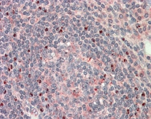 IHC staining of FFPE human tonsil with CTDSP1 antibody at 5ug/ml. HIER: steamed with pH6 citrate buffer, AP-staining.