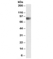 Western blot testing of human duodenum lysate with NOD1 antibody at 0.5ug/ml. Predicted molecular weight: ~107kDa, observed here at ~85kDa.
