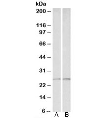 Western blot testing of human liver [A] and heart [B] lysates with Peroxiredoxin 6 antibody at 0.1ug/ml. Expected molecular weight: ~25kDa.~