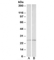 Western blot testing of human liver [A] and heart [B] lysates with Peroxiredoxin 6 antibody at 0.1ug/ml. Expected molecular weight: ~25kDa.