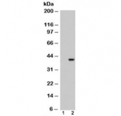Western blot of HEK293 lysate overexpressing ARA9 probed with ARA9 antibody (mock transfection in lane 1). Predicted molecular weight: ~37 kDa.