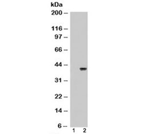 Western blot of HEK293 lysate overexpressing ARA9 probed with ARA9 antibody (mock transfection in lane 1). Predicted molecular weight: ~37kDa.