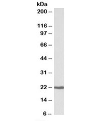 Western blot testing of Daudi lysate with CBFB antibody at 0.3ug/ml. Predicted molecular weight: ~22kDa.