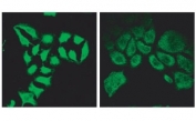 Immunofluorescence testing of methanol-fixed HeLa cells before (left) and after (right) introduction of siRNA using SPG20 antibody at 2ug/ml.