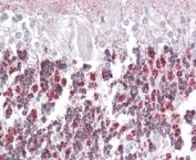 IHC staining of FFPE human cerebellum with Laforin antibody at 4ug/ml. HIER: steamed with pH6 citrate buffer, AP-staining. Pixulate staining in the cells of the granular layer is seen.