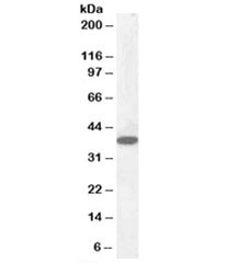 Western blot testing of human cerebellum lysate with Laforin antibody at 0.1ug/ml. Predicted molecular weight: ~37kDa.~