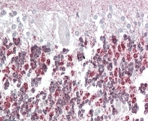 IHC staining of FFPE human cerebellum with Laforin antibody at 4ug/ml. HIER: steamed with pH6 citrate buffer, AP-st