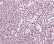IHC staining of FFPE human thymus with NIPP1 antibody at 4ug/ml. HIER: steamed with pH6 citrate buffer, AP-staining. Speckled staining of the nuclei is seen.