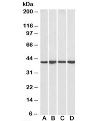 Western blot testing of human HeLa [A], HepG2 [B], Jurkat [C] and mouse NIH3T3 [D] nuclear lysate with NIPP1 antibody at 1ug/ml. Predicted molecular weight: ~39kDa.~
