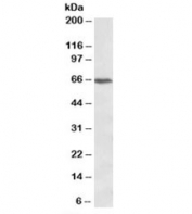 Western blot testing of Jurkat lysate with CACNB2 antibody at 1ug/ml. Predicted molecular weight: ~68kDa.
