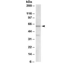 Western blot testing of human cerebellum lysate with VGLUT2 antibody at 2ug/ml. Molecular weight: the expected ~60kDa band and the additional ~37kDa band are both blocked by the immunizing peptide.
