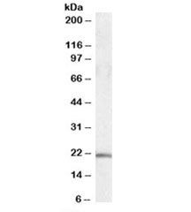 Western blot testing of human cerebellum lysate with U2AF1L4 antibody at 0.1ug/ml. Predicted molecular weight: ~21kDa.