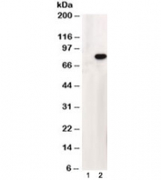 Western blot testing of HEK293 lysate overexpressing human ABCD1 and probed with ABCD1 antibody at 1ug/ml (mock transfection in lane 1). The predicted molecular weight is ~83kDa which is observed in transfected lysate but human brain lysate shows a 50kDa band.