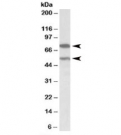 Western blot testing of human cerebellum lysate with PRODH antibody at 0.3ug/ml. Both isoforms are detected in this image.