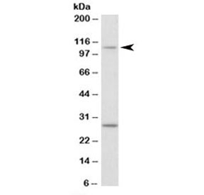Western blot testing of NIH3T3 lysate with Myo1H antibody at 0.1ug/ml. The expected ~110kDa band and the additional ~28kDa band are both blocked by the immunizing peptide.~