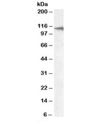 Western blot testing of human liver lysate with CLEC16A antibody at 2ug/ml. Predicted molecular weight: ~118kDa.