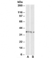 Western blot testing of human heart [A] and human kidney [B] lysates with LDHB antibody at 0.3ug/ml. Predicted molecular weight: ~36kDa.