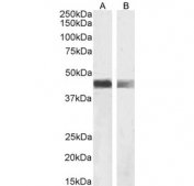 Western blot testing of A) human duodenum and B) rat heart tissue lysate with Smooth muscle alpha Actin antibody. Predicted molecular weight: ~42 kDa.