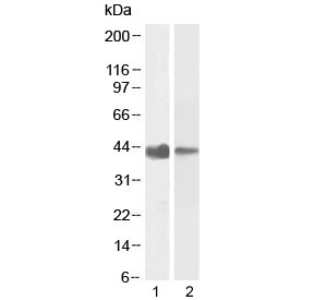 Western blot testing of 1) human duodenum and 2) rat duodenum lysate with smooth muscle alpha Actin antibody at 0.1ug/ml. Predicted molecular weight: ~42 kDa.~
