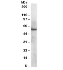 Western blot testing of HepG2 lysate with ERp57 antibody at 1ug/ml. Predicted molecular weight: ~57kDa.