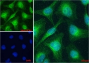 IF/ICC testing of human HeLa cells with Alexa Fluor 488 secondary (1ug/ml) and PTCH1 antibody (green, 5ug/ml). Blue = DAPI nuclear counterstain.