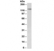 Western blot testing of mouse fetal kidney lysate with PTCH1 antibody at 2ug/ml. Predicted molecular weight ~161/154/144 kDa (isoforms L/M/S) with glycosylated PTCH1 visualized at ~200 kDa.