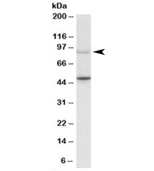 Western blot testing of Jurkat lysate with WHIP antibody at 1ug/ml. Predicted molecular weight: ~72/85~90kDa (unmodified/ubiquitinated). Both observed bands are blocked by addition of immunizing peptide.~