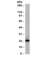 Western blot testing of Jurkat lysate with MAX antibody at 0.1ug/ml. Two forms of MAX may be observed: 16-17kDa and 21-22kDa.