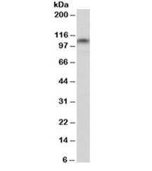 Western blot testing of rat brain lysate with PSD95 antibody at 0.3ug/ml. Molecular weight: routinely observed at ~95kDa.