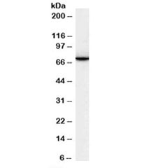 Western blot testing of human lymph node lysate with SWAP70 antibody at 0.1ug/ml. Predicted molecular weight: ~70kDa.