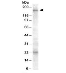 Western blot testing of human cerebellum lysate with ABCC8 antibody at 0.5ug/ml. The expected ~170kDa band and the additional ~23kDa band are both blocked by the immunizing peptide.