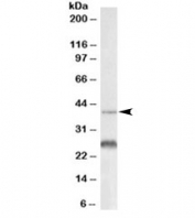 Western blot testing of mouse colon lysate with Cxcr2 antibody at 0.3ug/ml. Predicted molecular weight: the expected ~40kDa band and the additional ~28kDa band are both blocked by the immunizing peptide.