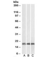 Western blot of human (A), mouse (B) and rat (C) skeletal muscle lysates with UBE2L3 antibody at 0.03ug/ml. Predicted molecular weight: ~18 kDa.