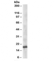 Western blot testing of HeLa lysate with UBE2L3 antibody at 0.5ug/ml. Predicted molecular weight: ~18 kDa.