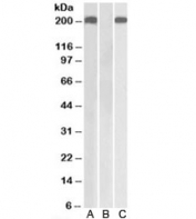 Western blot testing of HEK293 lysate overexpressing human THBS1-MYC with Thrombospondin antibody [1ug/ml] in Lane A and probed with anti-MYC [1/1000] in lane C. Mock-transfected HEK293 probed with Thrombospondin antibody [1ug/ml] in Lane B.