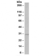 Western blot testing of human liver lysate with TIRAP antibody at 1ug/ml. Predicted molecular weight: ~25kDa, observed here at ~30kDa.