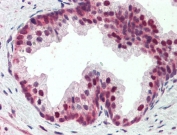 IHC testing of FFPE human prostate tissue with PDCD4 antibody at 5ug/ml. Required HIER: steamed antigen retrieval with pH6 citrate buffer; AP-staining.