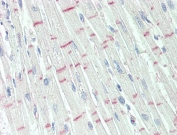 IHC testing of FFPE human heart tissue with GPR17 antibody at 10ug/ml. Required HIER: steamed antigen retrieval with pH6 citrate buffer; AP-staining.