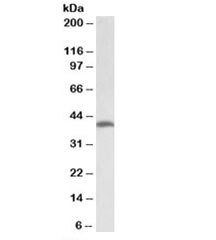 Western blot testing of human colorectal cancer lysate with THNSL2 antibody at 2ug/ml. Predicted molecular weight: ~45kDa.
