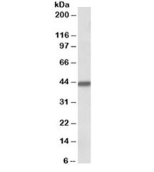 Western blot testing of human breast cancer lysate with Keratin 19 antibody at 0.1ug/ml. Predicted/observed molecular weight ~43/40-43kDa.