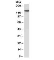 Western blot testing of human spleen lysate with SP140 antibody at 2ug/ml. Expected molecular weight: 100/140kDa.