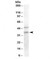 Western blot testing of human placenta lysate with GULP1 antibody at 0.2ug/ml. The expected ~35kDa band and the additional ~46kDa band are both blocked by the immunizing peptide.