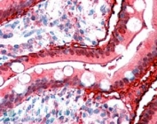 IHC staining of FFPE human small intestine with FABP2 antibody at 2.5ug/ml. HIER: steamed with pH6 citrate buffer, AP-staining.