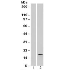 Western blot testing of HEK293 lysate overexpressing FABP2 with FABP2 antibody [mock transfection in lane 1]. Predicted molecular weight: ~15kDa.