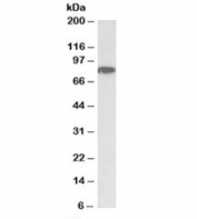 Western blot testing of HeLa nuclear lysate with CHUK antibody at 1ug/ml. Predicted molecular weight: ~85kDa.