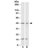 Western blot of mouse (A) and rat (B) adrenal gland lysate with PNPLA3 antibody at 0.01ug/ml. Expected molecular weight: ~45 kDa.